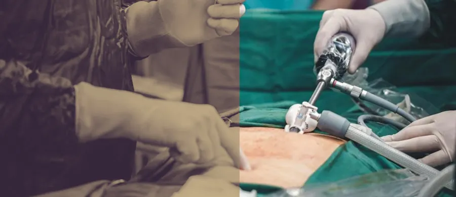 evolucion laparoscopia